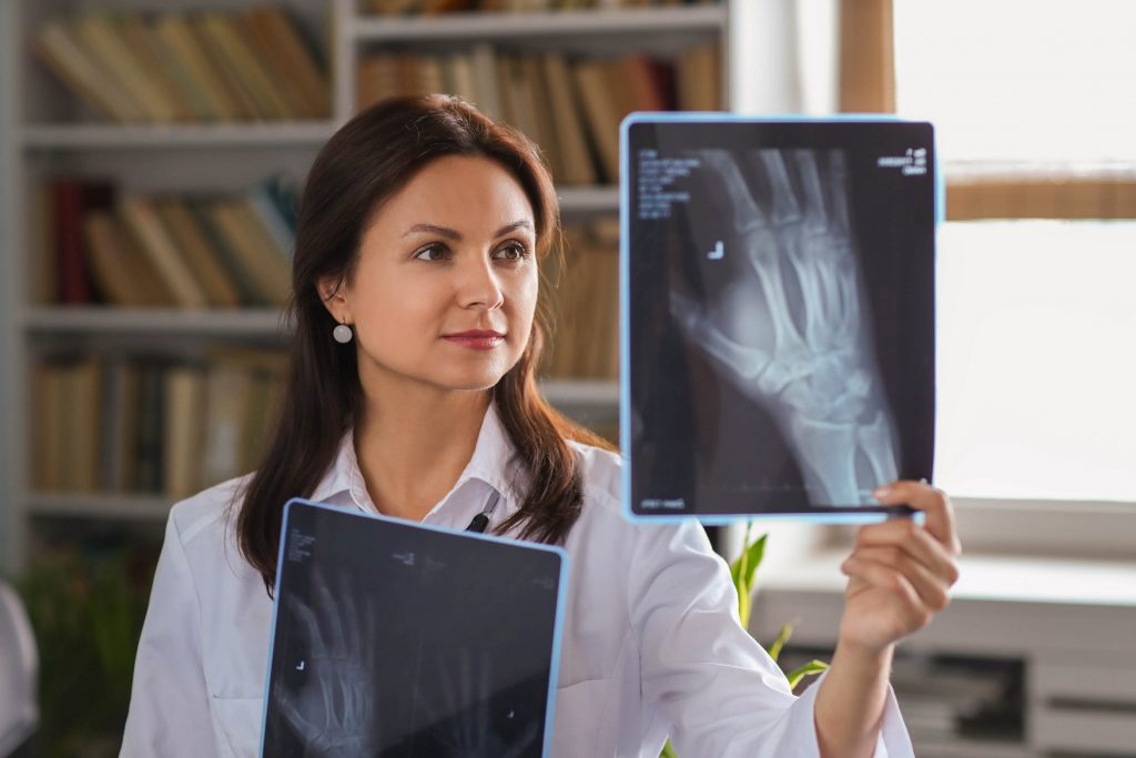 Osteoporosis: todo lo que necesitas saber