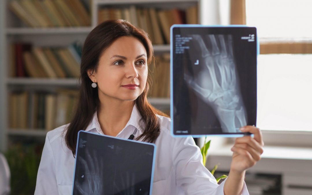 Osteoporosis: Todo lo que necesitas saber