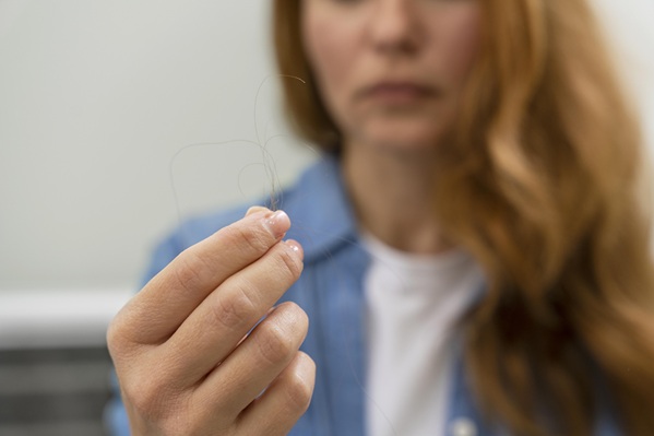 Vitamina D y caída del cabello: ¿Cuál es la relación?